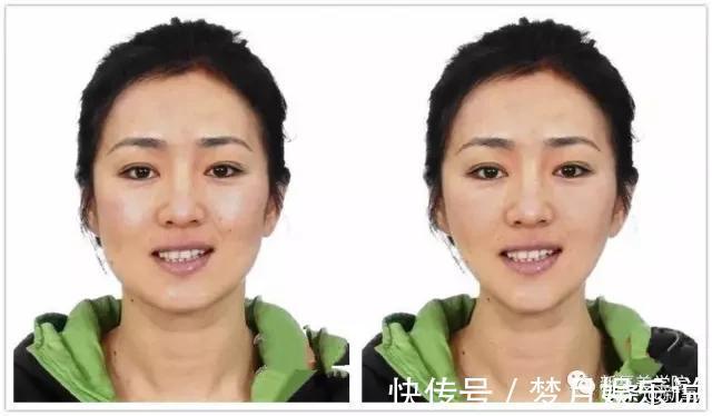 眉眼|网上盛传加宽眉眼间距幼态立马出来,真这么神奇?
