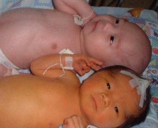 营养物质|孩子出生后出现黄疸,多半是孕期时的坏习惯导致,要留心!