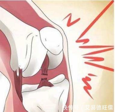 到底|膝关节总是“咔咔”的响,到底是怎么回事?