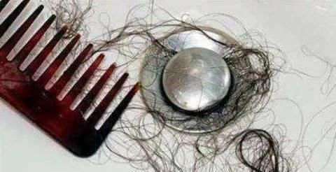 头皮|一天中什么时候洗头发会头疼、掉发?多数人做法不对,要及时纠正