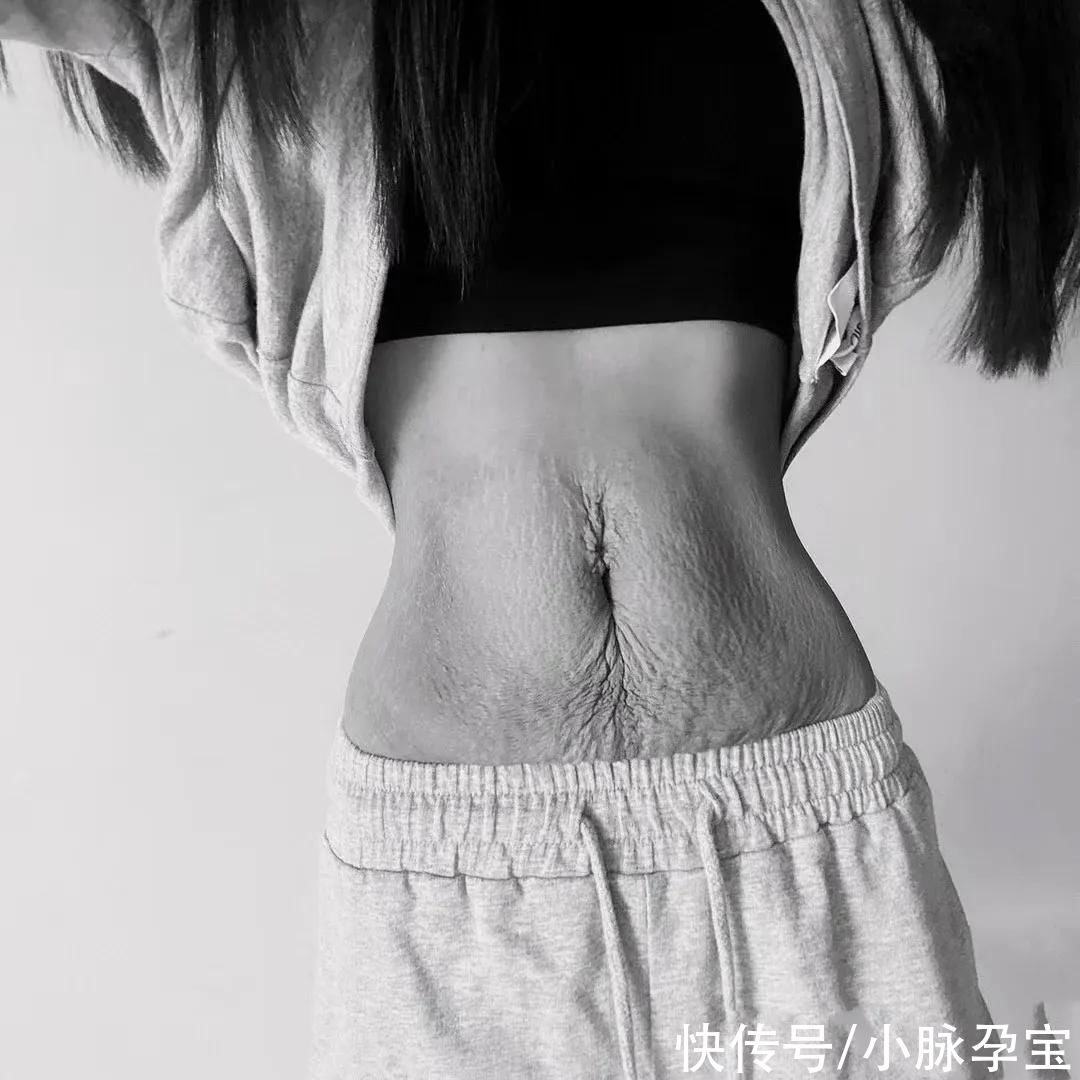 孕育|妊娠纹、大肚腩、大粗腿...那又怎样？我孕育了一个宝宝