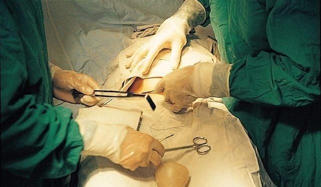 手术|宝妈吐槽分娩时的尴尬：头胎顺产被“剃毛”，二胎剖腹产也没逃掉