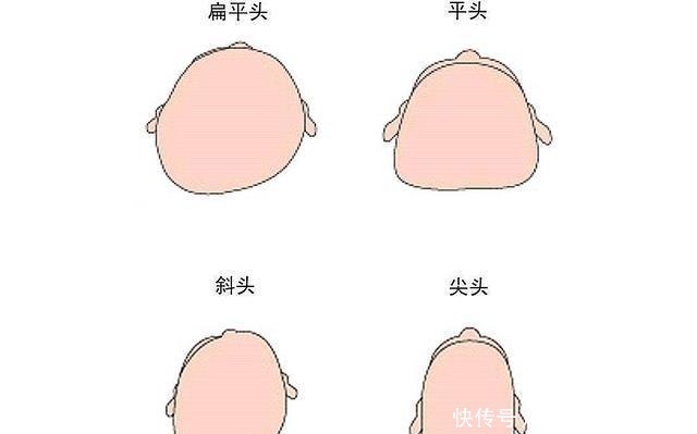 小碰|“妈妈别给我睡扁头”，为何老一辈坚持给娃睡扁头，真的很毁颜值！