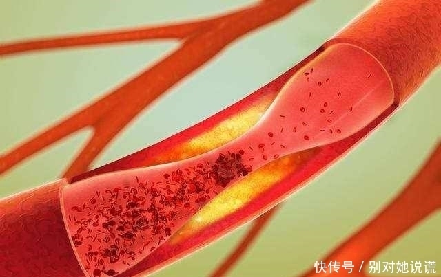 三高疾病|此物是“天然血栓药”,分享到圈子里,很多人会感激你一辈子!