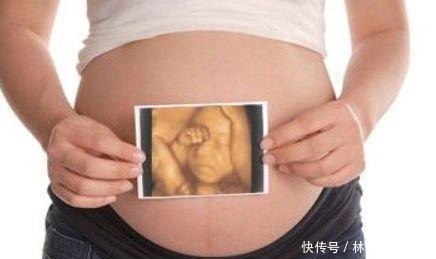 四维彩超|四维检查时,小家伙竟然在孕妈腹中干“坏事”,医生都被逗笑了