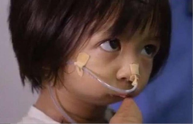 手术|女孩一出生就没有手脚，没有嘴，3岁才开口吃到第一口饭