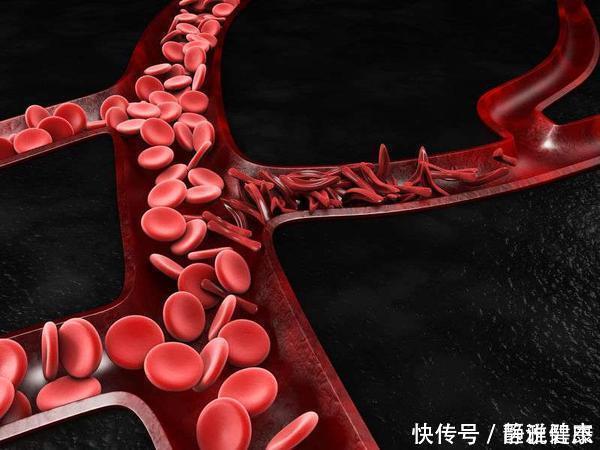 黏稠度|血管怕堵,常吃这5种食物,有降血脂预防血栓的作用