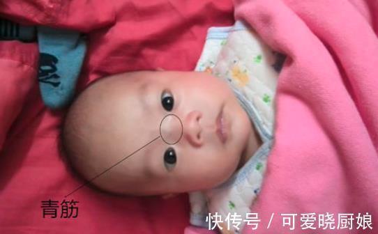 磨娘筋|老人言“鼻梁青,磨娘精”,鼻梁上有青筋的宝宝真的难带吗?