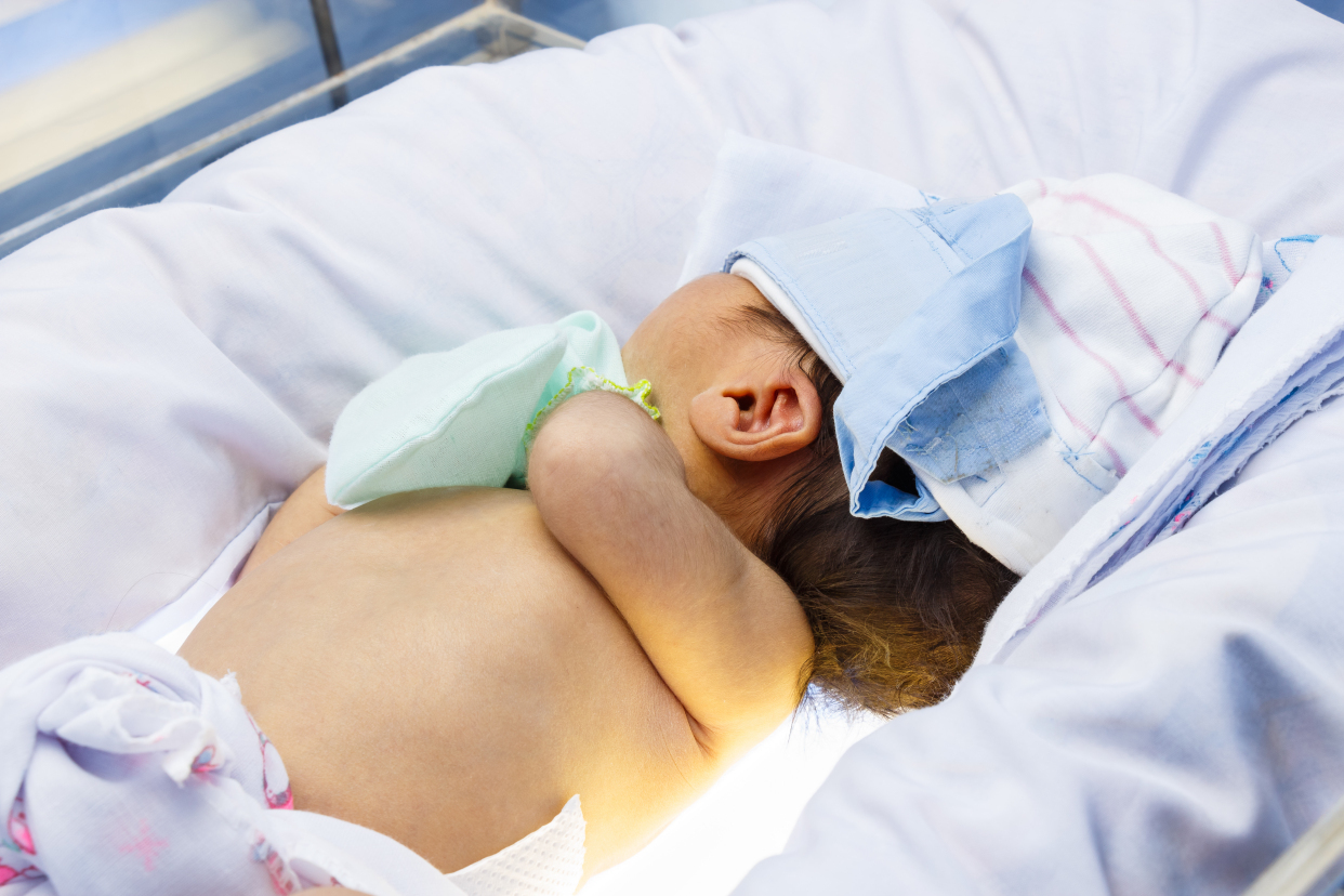 新生儿黄疸|宝宝黄疸，哪种需警惕？哪种不用管