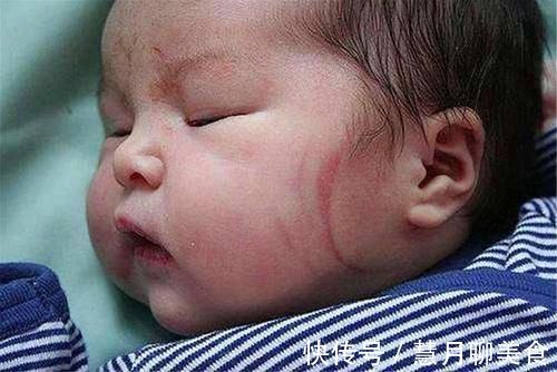 小霞|宝宝脸上产钳印难消,婆婆抱怨儿媳没本事,儿媳一句话回怼太解气