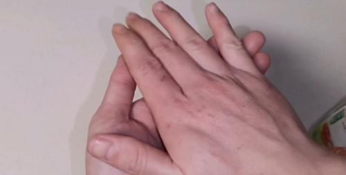 晨曦|赶紧把白醋倒在手心搓一搓,真的太厉害了,活了20年才知道!