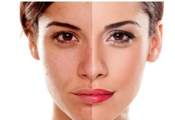 73岁老奶奶,从重度肝硬化到肝功正常,半年只用了1个诀窍