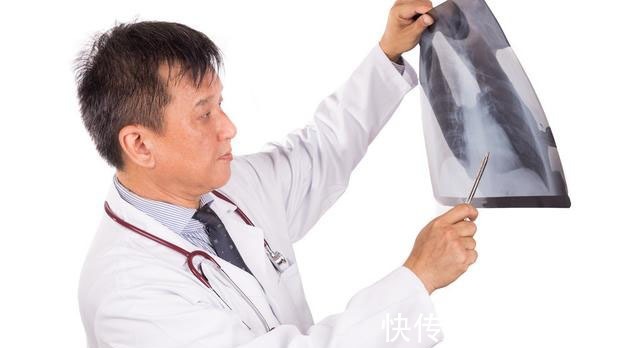 肿瘤|肺癌的诊断为什么要做那么多检查,哪一个最重要,越痛苦越重要