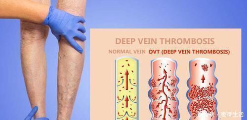 阳台种小葱,又细又黄乱糟糟?教你几招,又粗又壮,又粗又壮