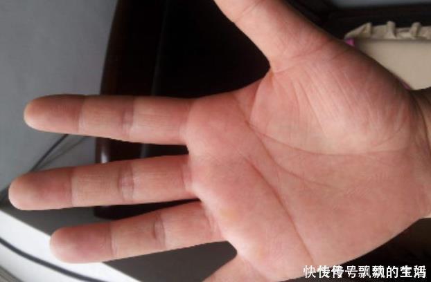 血液循环|肾好的男性,手脚多有4大好现象,你若有1个,说明肾保养的很不错