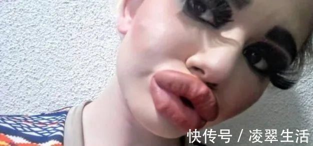 sofia 21次丰唇手术之后,这个妹子的嘴唇现在长这样…