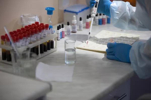 血型竟能决定寿命A型、B型、AB型、O型,哪种血型的人最长寿