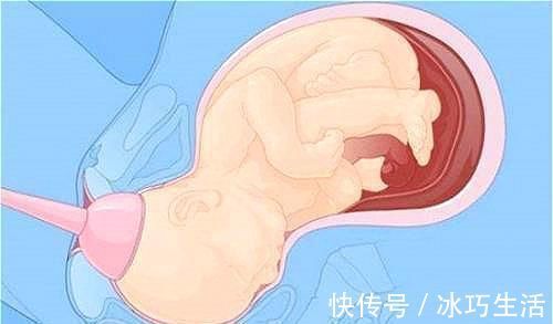 过程|顺产宝宝是怎么“生”的一组图带你了解全过程,妈妈其实不孤单