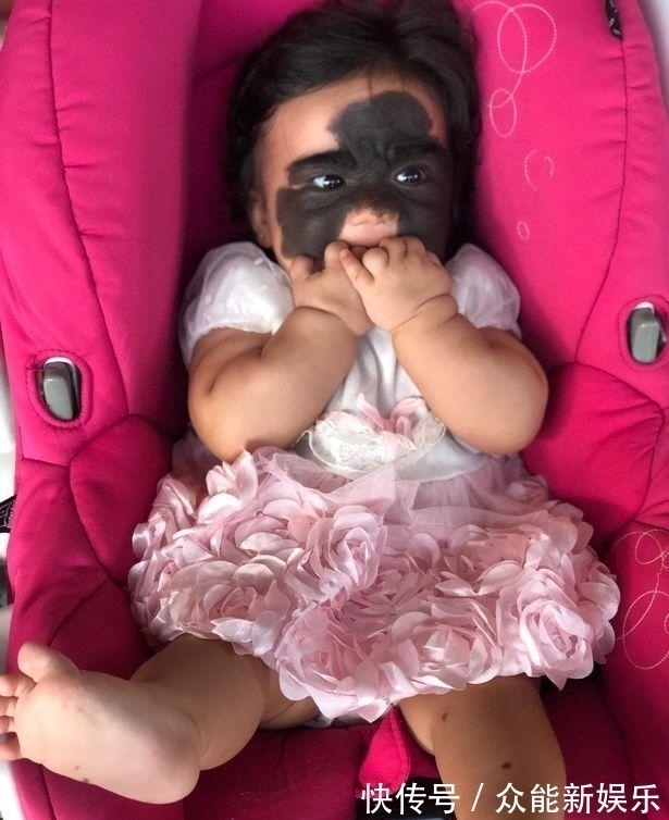 外科医生|真人版“蝙蝠侠”,美国一婴儿患罕见黑色素痣,形状酷似蝴蝶翅膀