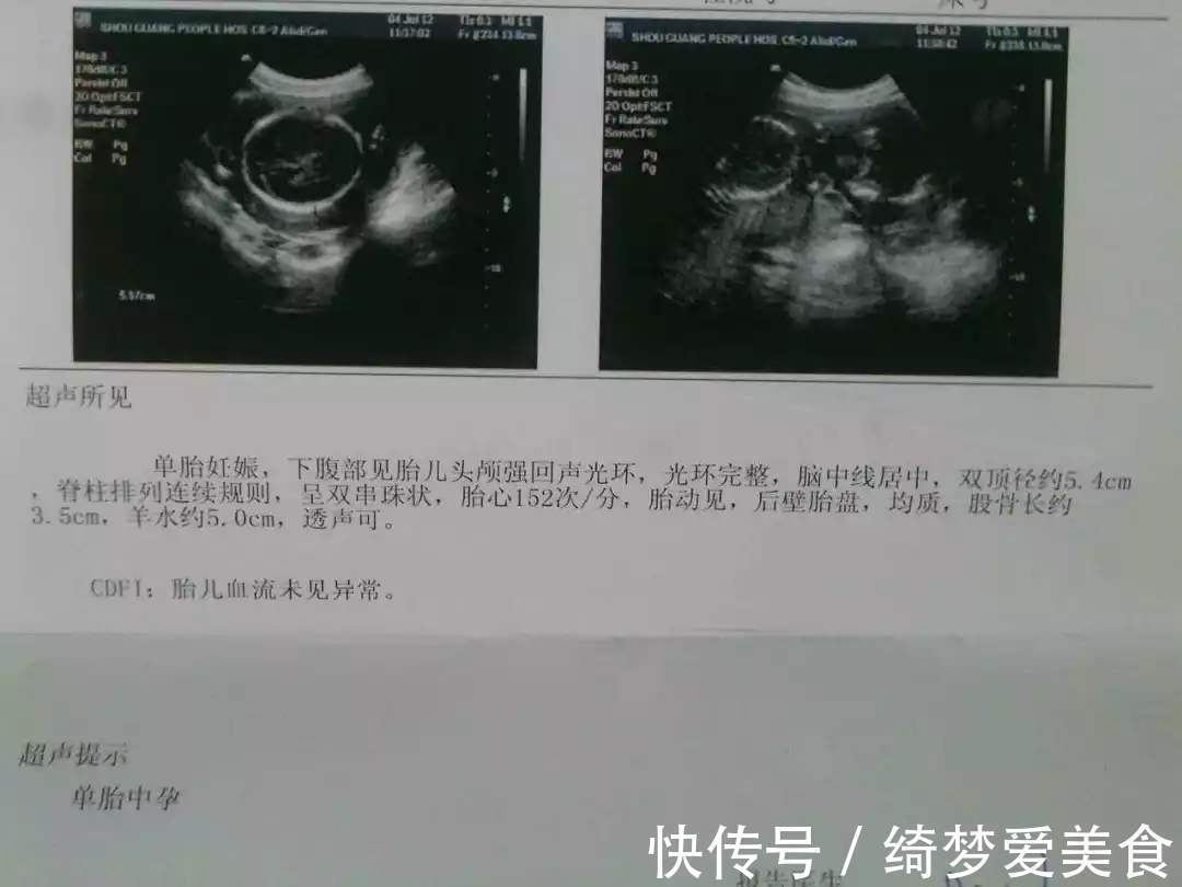 指标|刚怀孕,第一次孕检别盲目,只要这3项指标正常,胎儿就是健康的