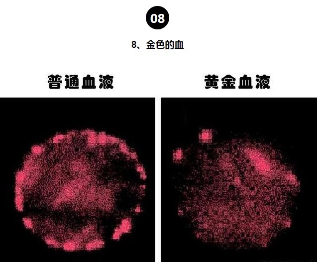 等位基因|罕见的身体特征只有少数人身上才拥有的10个罕见的特征