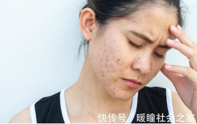 咸菜|血脂高不高,看脸就知道,若没4种异常,恭喜你,血管还算健康