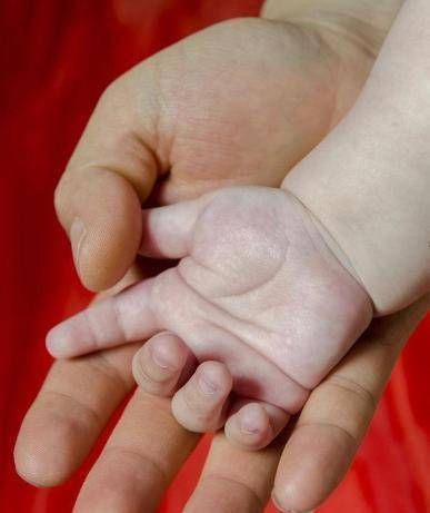 宝宝|孩子聪明不聪明,看看小手就知道,你家宝宝的小手是这样的吗