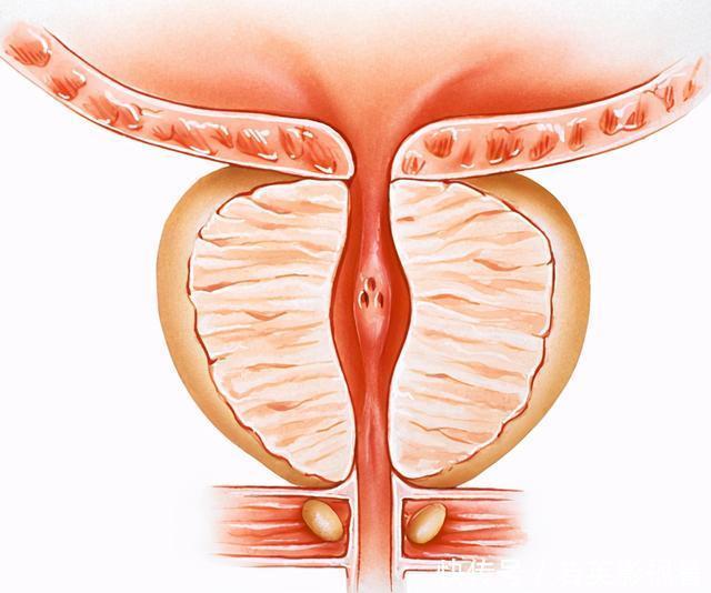 “华山论剑”，治疗良性前列腺增生，四大王牌药物，如何选择？