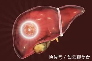 養肝護肝|轉告家人：這3種食物很“傷肝”，日常飲食盡量遠離，養護肝臟