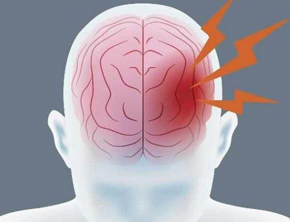 高血压者|56岁男子突发脑溢血,抢救后却偏瘫,医生这东西再好喝也别碰