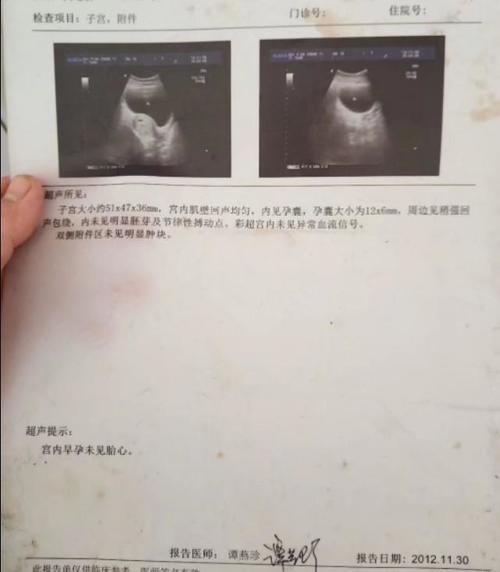 怀孕|怀孕二个多月,突然起身或躺下会感觉到胎动,这是怎么回事?