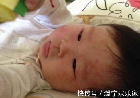 抗生素|宝宝出现9个特点,可能是患急疹了,教你5个方法,在家就能护理