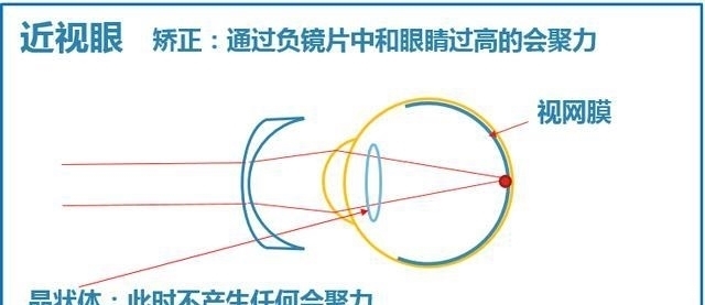 高度近视闭上眼睛不使用装盲人, 几年以后