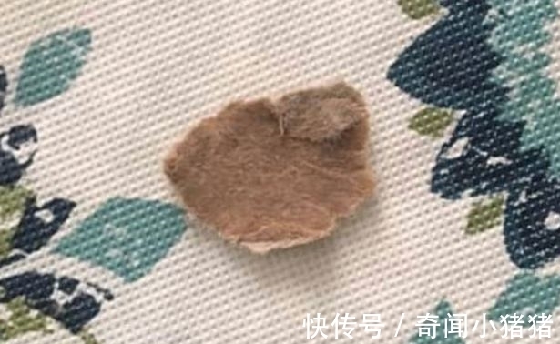 小宝宝|女婴口中出现大“黑点”,吓坏了宝妈,医院检查后哭笑不得