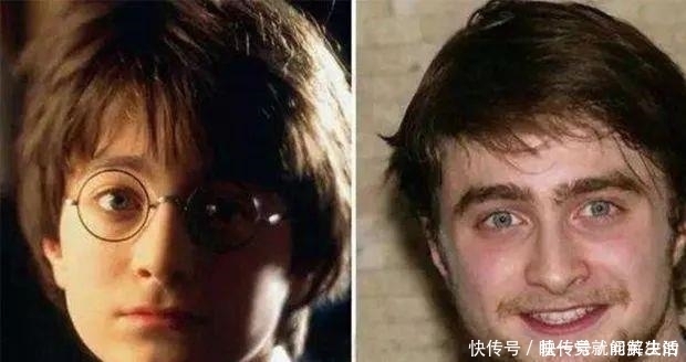 阳光帅气|小时侯颜值高,为什么长大就变丑,“元凶”竟是这三个坏习惯