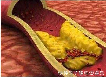 柚子|血管老化难疏通早晚吃“3种”，溶解血栓“一把手”！