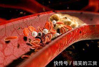 慢性疾病|经常吃“腐乳”的人,会有什么变化或许多数人不清楚,早知早好