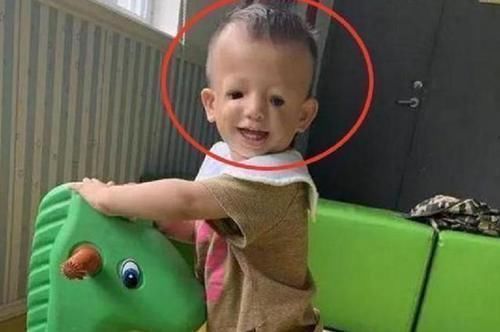 家长|“鸟脸妈妈”生孩子遭家人反对，宝宝出生后，妈妈十分后悔