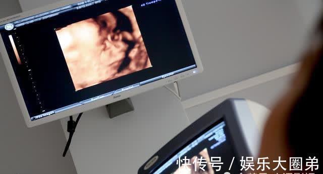 无痛针|无知差点害了孕妇,有些孕产知识,需要家庭成员一起学习