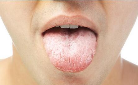 湿气|脾胃不好,舌苔白厚有齿痕、舌头有裂痕,该怎么调理?