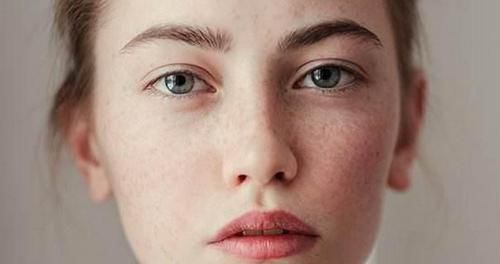 为什么女性脸上容易长斑点？找到原因了，3种办法让自己慢慢变美