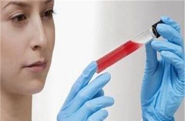 慢性疾病|患有高血脂的人，日常多吃这几样食物，血脂会乖乖“听话”