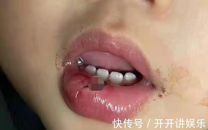 美容|孩子误吞硬币、意外受伤该怎么办?儿科医生提醒:这样做才正确