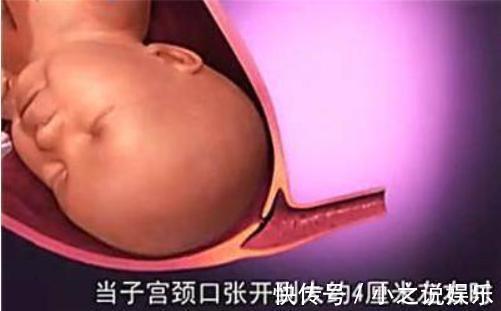 用力过猛|胎儿那么大,如何从那么小的产道出来看完知道女人有多伟大!