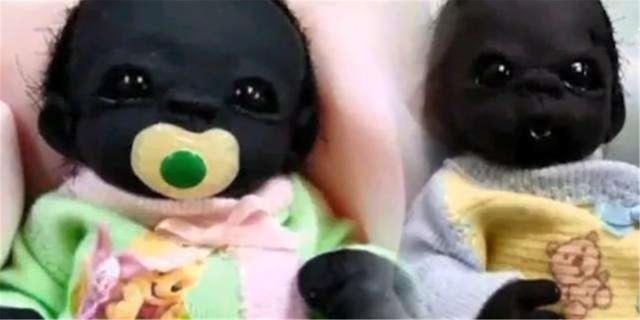 自卑|“世界最黑婴儿”如今5岁了,他变白了吗?网友:不愧是世界之最