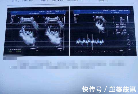 医生|双胞胎长得不一样,婆婆怂恿儿子去做亲子鉴定,医生调侃真无知
