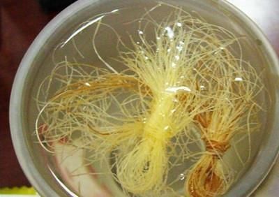 玉米|柠檬和玉米须，治疗肾结石有这奇效？