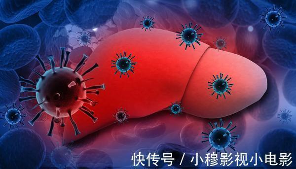 癌细胞|从肝炎恶化成肝癌,一般要多久?常感觉乏力,体重变轻,该检查了