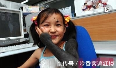 女子|奇闻:32岁女子早产生下“狼孩” 看到孩子,网友:扔掉吧