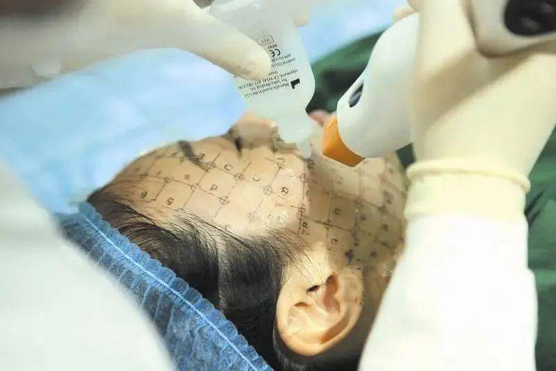 皮肤 只有白皮肤的人才能做热玛吉?关于热玛吉,要避开这些常见的8个误区!